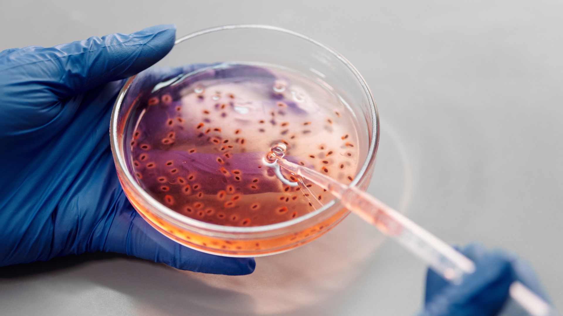 Bacteria Burkholderia Mata a 4 en BCS: ¿Cómo se Transmite y Cuáles son ...