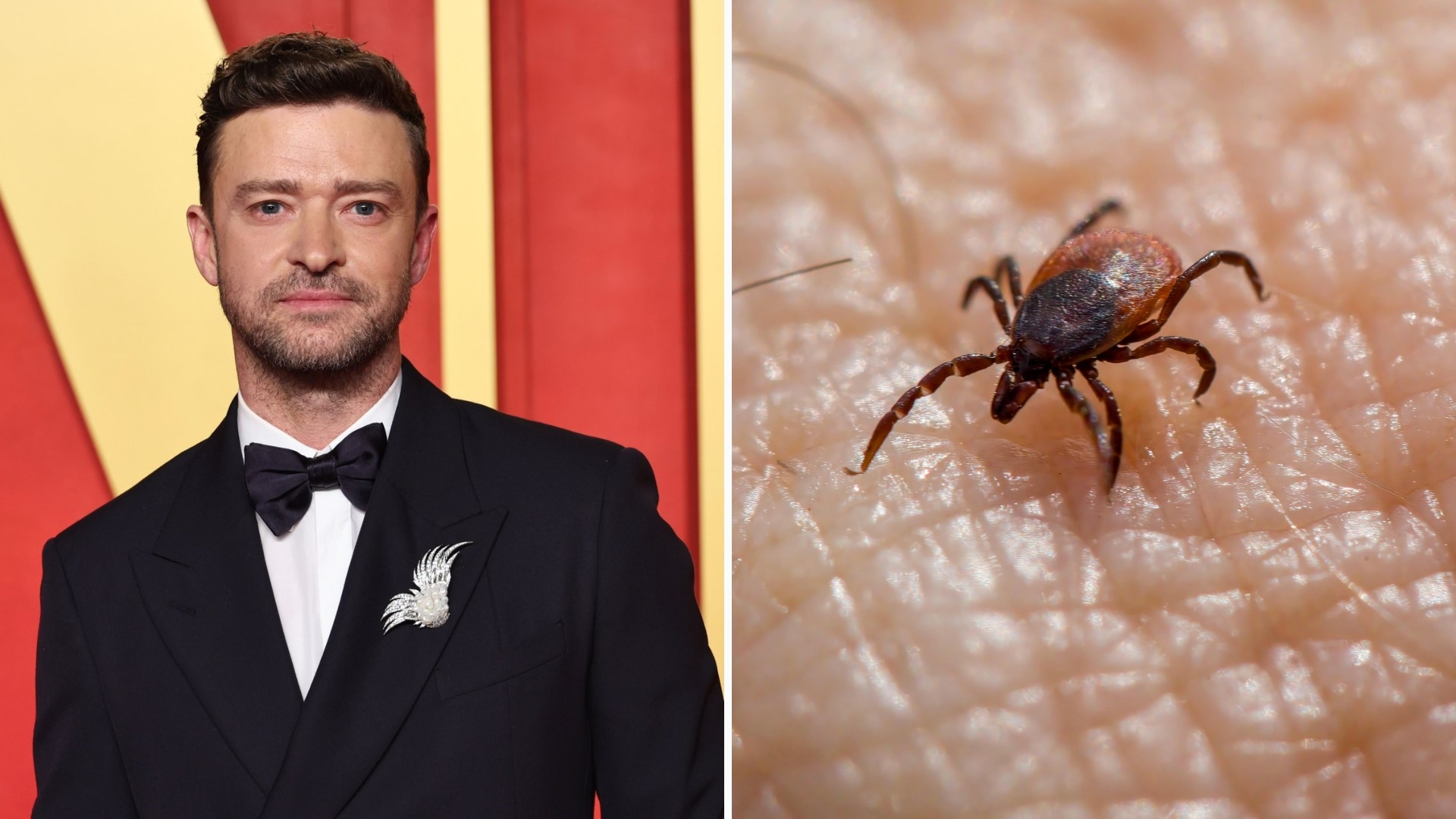 https://static-live.nmas.com.mx/nmas-news/styles/corte_16_9/cloud-storage/2025-07/justin-timberlake-enfermedad-lyme-que-es1.jpg