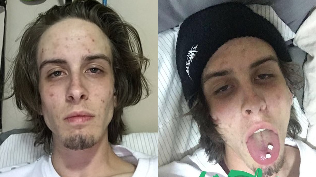 antes y despues de las drogas