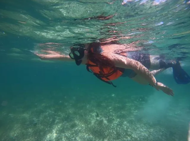 Tras la amputación de su pierna y seis quimioterapias, Giselle camina con prótesis, ejerce como abogada y lleva una vida plena
